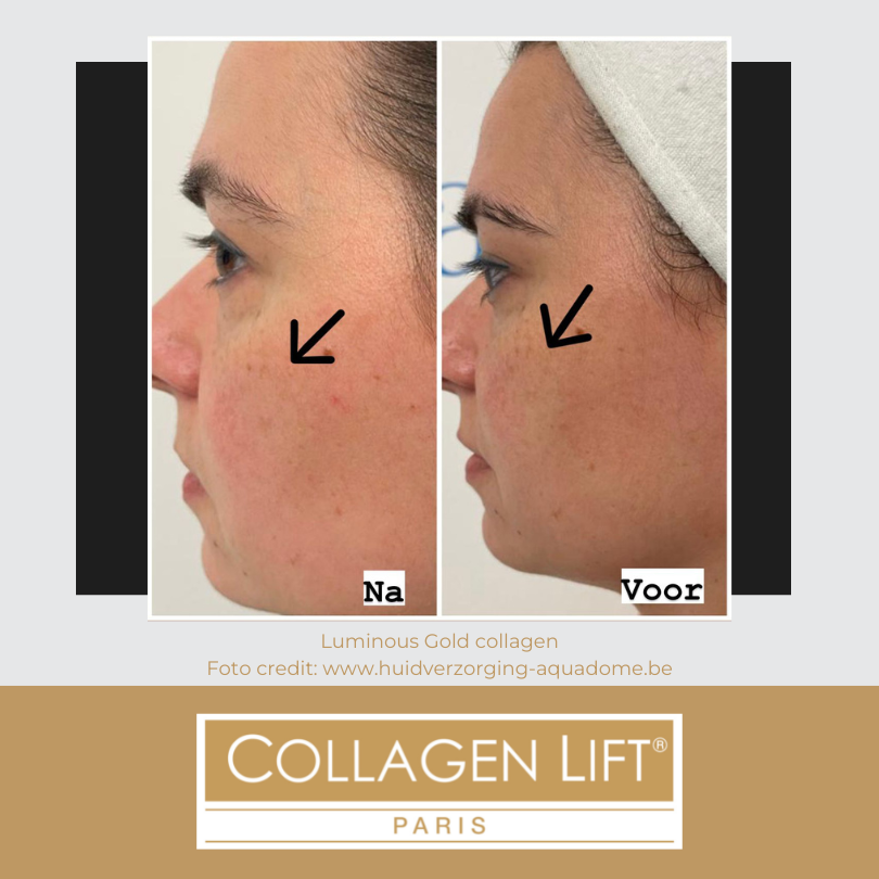 Luminous Gold: anti-age collagen for wrinkles and sun damage