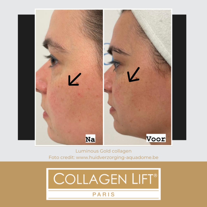Luminous Gold: anti-age collagen for wrinkles and sun damage