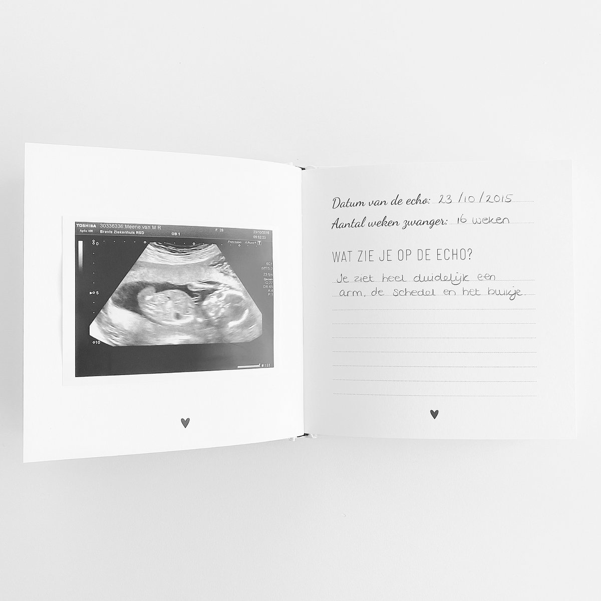 Echo - Fotobuch für den Ultraschall