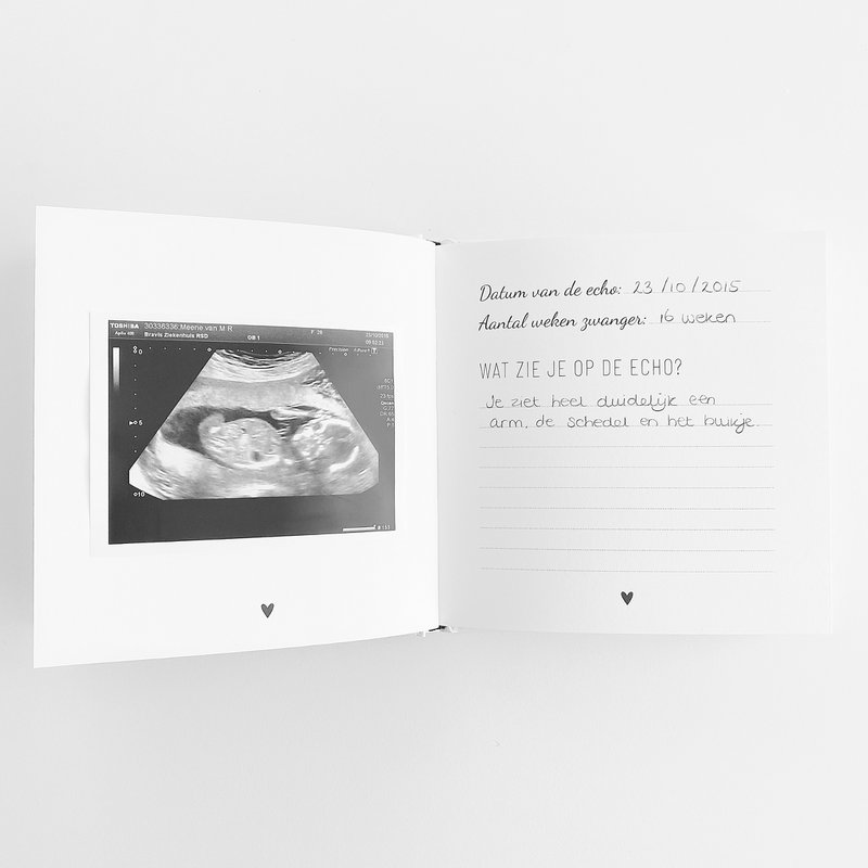 Echo - Photo book for the ultrasounds