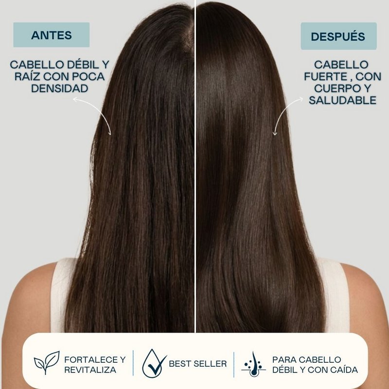 Shock Caída ADN Molecular – Loción Anticaída Capilar