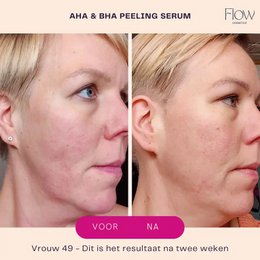 AHA & BHA Peeling Serum - Peeling face