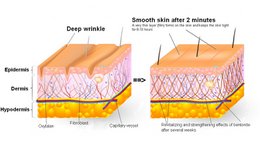 SUPREME DIRECT EYE LIFT - sofortiges Augenlifting - Ergebnisse in 2 Minuten