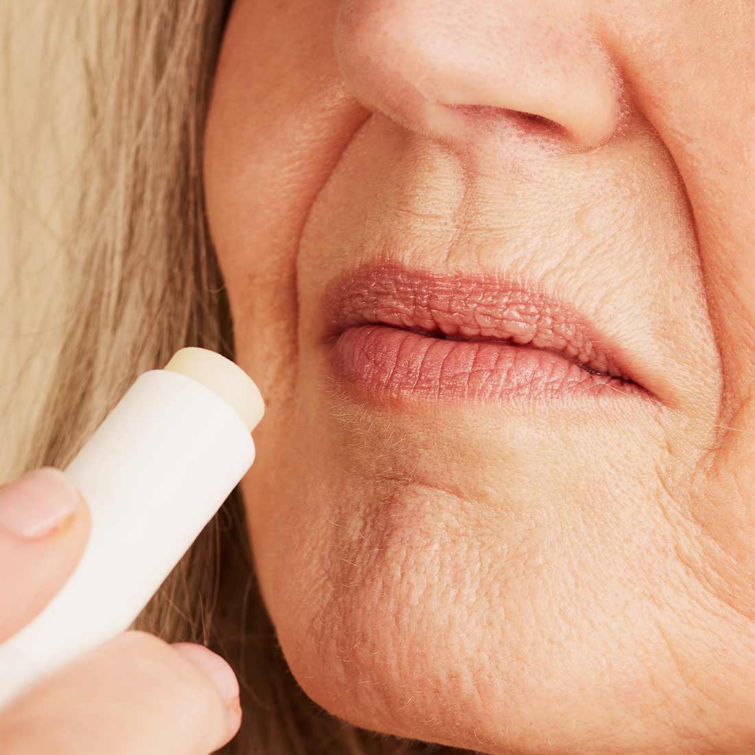 parte superior del labio
