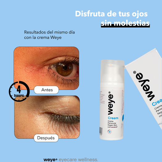 Oog creme