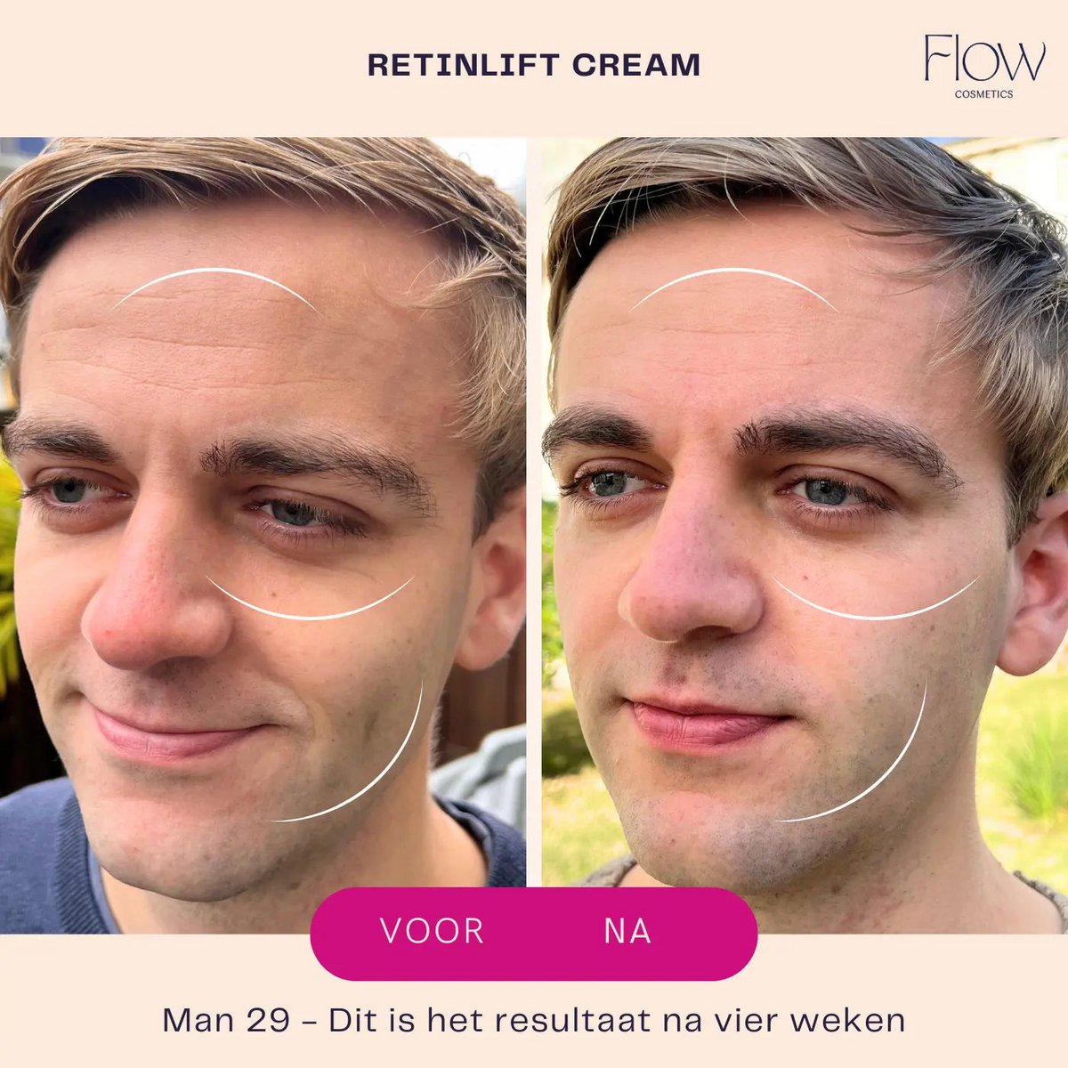RetinLift 3-in-1 – Retinol-Creme