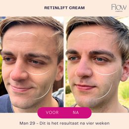 RetinLift 3-in-1 – Retinol-Creme